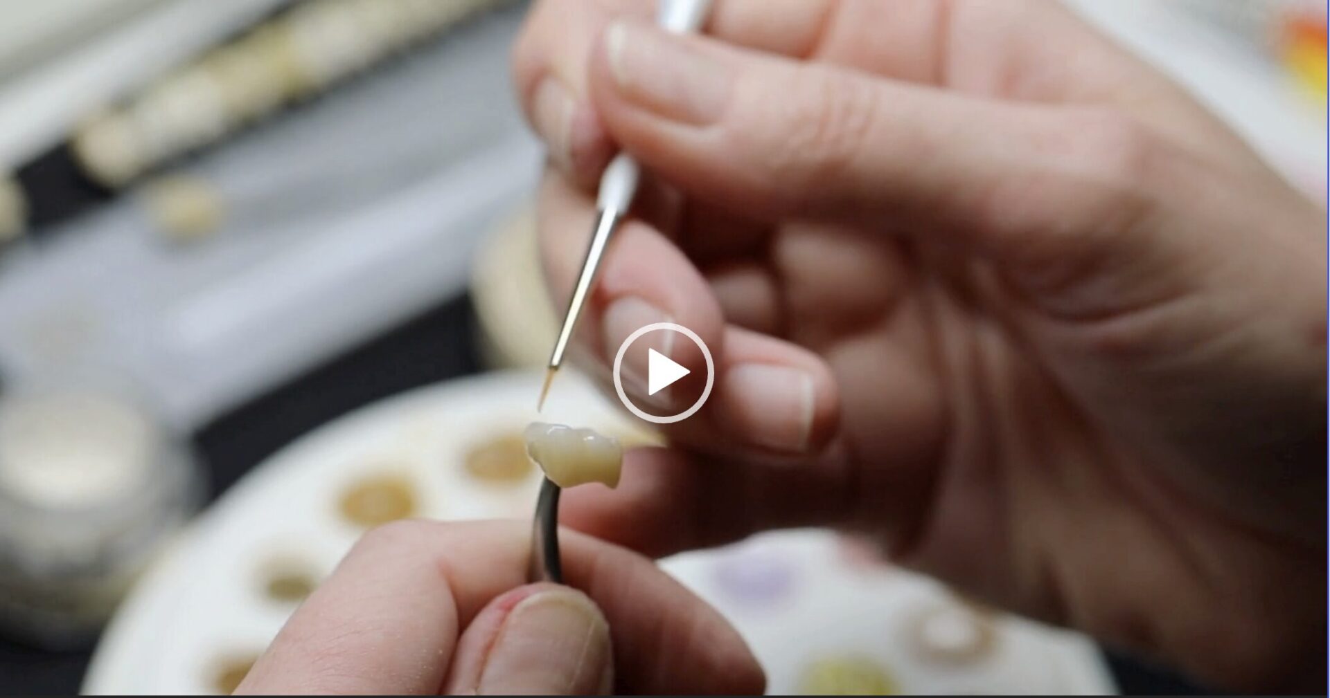 Close-up of hands fitting a small dental prosthetic with tweezers on a tooth model
